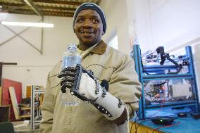 S. African man gets artificial hand made by 3D printer