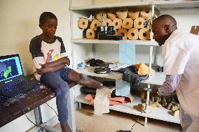 Ugandan hospital scans boy's leg to make prosthesis with 3D printer