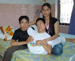 Separated Vietnamese conjoined twin Viet dies at 26