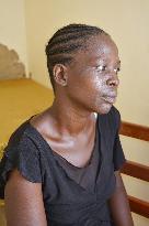 Woman abducted by LRA rebels shows scars