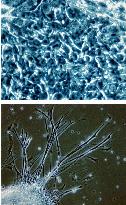 (2)Kyoto University institute grows Japan's first ES cells