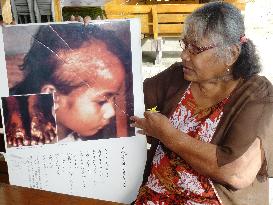 Citizens of nuclear-bombed Marshall Islands yearn for Obama visit