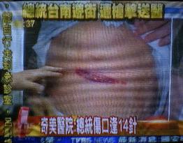 (5)Taiwan's president shot