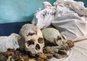 Biak residents collect remains of WWII Japanese soldiers