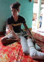Viet fisherman nursing leg broken by Chinese ship's attack in Paracels