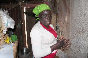 Victim of 2007 Kenyan riot shows her burnt face