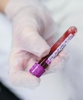 blood donor, sample, Hospital of St. Anna in Brno