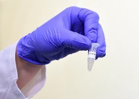 A rapid test for COVID-19 developed at the Immunology Institute at the Medical Faculty of Palacky University