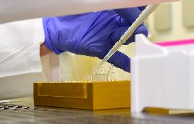 A rapid test for COVID-19 developed at the Immunology Institute at the Medical Faculty of Palacky University