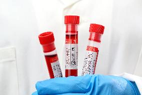 Test, testing, covid-19, coronavirus, vaccine, protective clothing, gloves, blood, laboratory flash, antibodies, research, glass tube, tubes