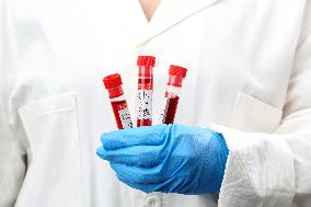 Test, testing, covid-19, coronavirus, vaccine, protective clothing, gloves, blood, laboratory flash, antibodies, research, glass tube, tubes