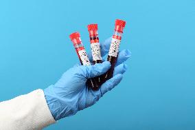 Test, testing, covid-19, coronavirus, vaccine, protective clothing, gloves, blood, laboratory flash, antibodies, research, glass tube, tubes