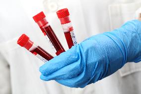 Test, testing, covid-19, coronavirus, vaccine, protective clothing, gloves, blood, laboratory flash, antibodies, research, glass tube, tubes