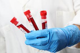 Test, testing, covid-19, coronavirus, vaccine, protective clothing, gloves, blood, laboratory flash, antibodies, research, glass tube, tubes