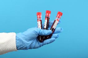 Test, testing, covid-19, coronavirus, vaccine, protective clothing, gloves, blood, laboratory flash, antibodies, research, glass tube, tubes