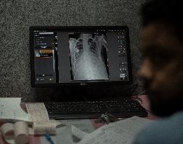 Covid Patients In Kashmir Hospital