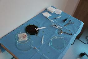 Hair Implants - Turkey