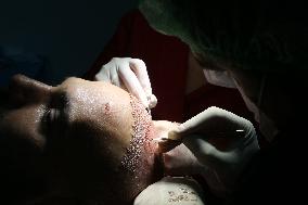 Hair Implants - Turkey