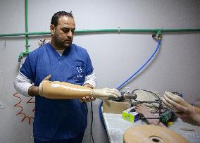 MIDEAST-GAZA CITY-BIONIC HANDS