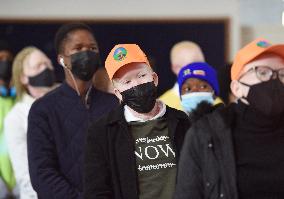 BOTSWANA-GABORONE-INTERNATIONAL ALBINISM AWARENESS DAY