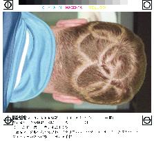 Olympic ring-shaped haircut