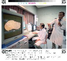 Remote medication system demonstrated