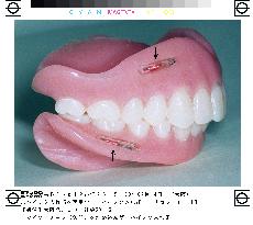 False teeth with embedded microchips receive patents