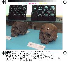 Brain tissues found in exhumed Yayoi-era human skulls