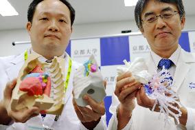 3D printer helpful in rare lung transplant in Kyoto