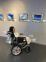 CHINA-SHANXI-PARALYZED ARTIST-EXHIBITION (CN)