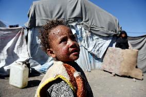 YEMEN-SANAA-REFUGEE CAMP