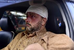 PAKISTAN-PESHAWAR-BLAST-INJURED