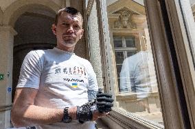 Modern Prosthetic Help For Injured Ukrainians