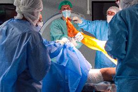 Knee joint replacement surgery in Kyiv