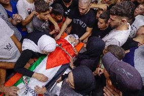 A Child Dies From His Wounds - Nablus