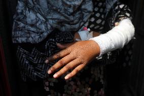 Aftermaths Garment Strike In Bangladesh