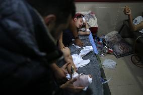 Injured Palestinian at Shuhada al-Aqsa Hospital Amidst Gaza-Israel Conflict