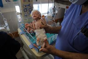 MIDEAST-GAZA-PALESTINIAN-ISRAELI CONFLICT-PREMATURE BABIES EVACUATED