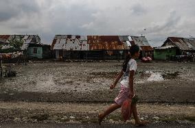 The Burden Of Leprosy In Indonesia