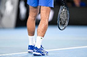 2024 Australian Open - Day 6 - Melbourne