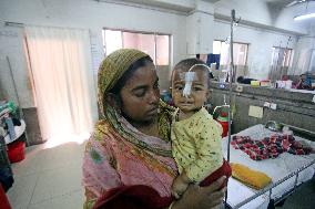 Child Patients At Dhaka Child Hospital - Bangladesh