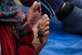 Leech Therapy Treatments - India