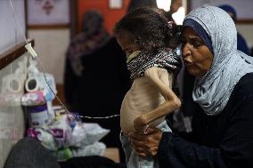 Malnutrition Issue in Gaza Amid Hamas-Israel Conflict