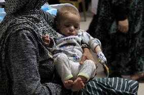 MIDEAST-GAZA-CHILDREN-MALNUTRITION