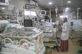 MIDEAST-GAZA-HOSPITAL-MALNUTRITION-CHILD