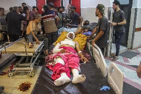 MIDEAST-GAZA CITY-ISRAEL-ATTACKS-INJURED PEOPLE