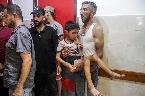 MIDEAST-GAZA CITY-ISRAEL-ATTACKS-INJURED PEOPLE