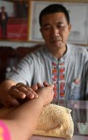 CHINA-GUANGXI-JINXIU-MOXIBUSTION THERAPY-INHERITOR (CN)