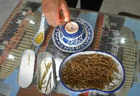 CHINA-GUANGXI-JINXIU-MOXIBUSTION THERAPY-INHERITOR (CN)