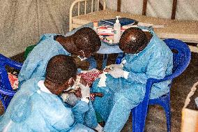 WHO Declares Mpox A Global Public Health Emergency